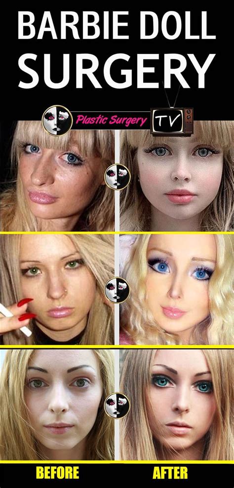 dolls plastic surgery reviews